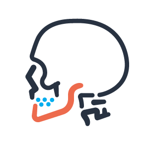 Moreno Valley Bruxism