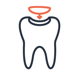 Moreno Valley Dental Fillings