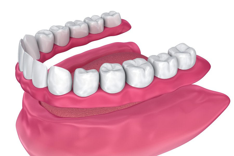 IMmediate Dentures