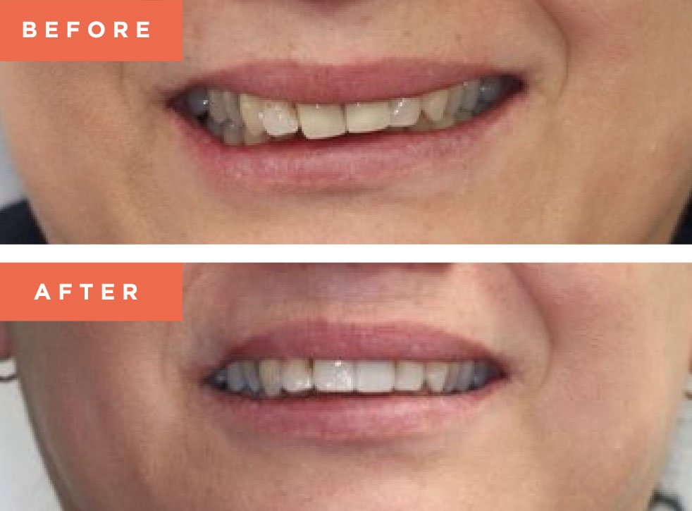 Moreno Valley Smile Gallery