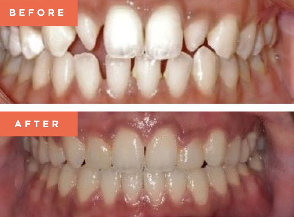 Moreno Valley Smile Gallery