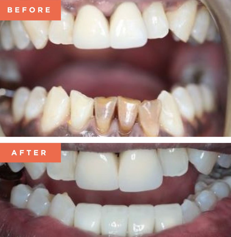 Moreno Valley Smile Gallery