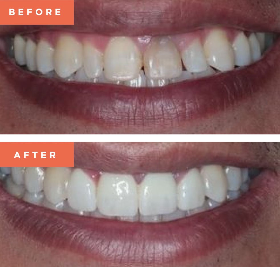 Moreno Valley Smile Gallery