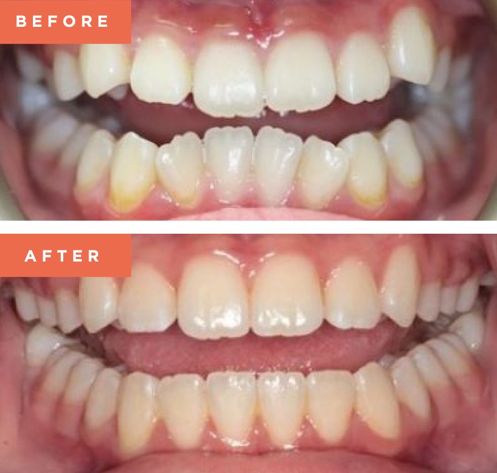 Moreno Valley Smile Gallery