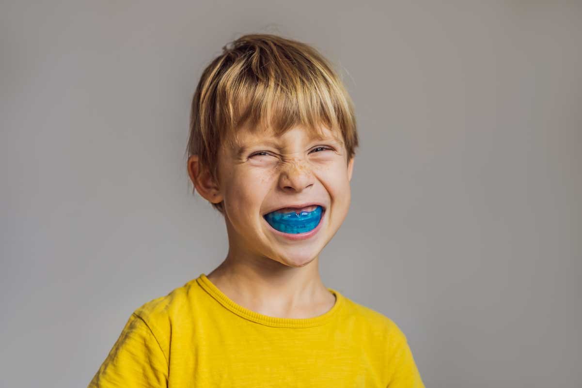 Mouth Guards
