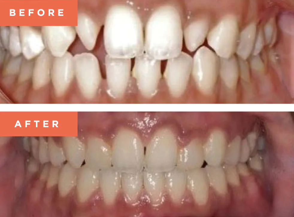 Moreno Valley Smile Gallery
