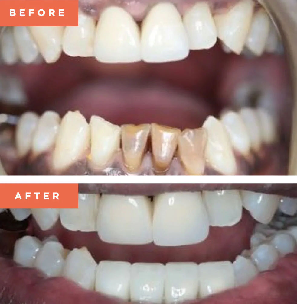 Moreno Valley Smile Gallery