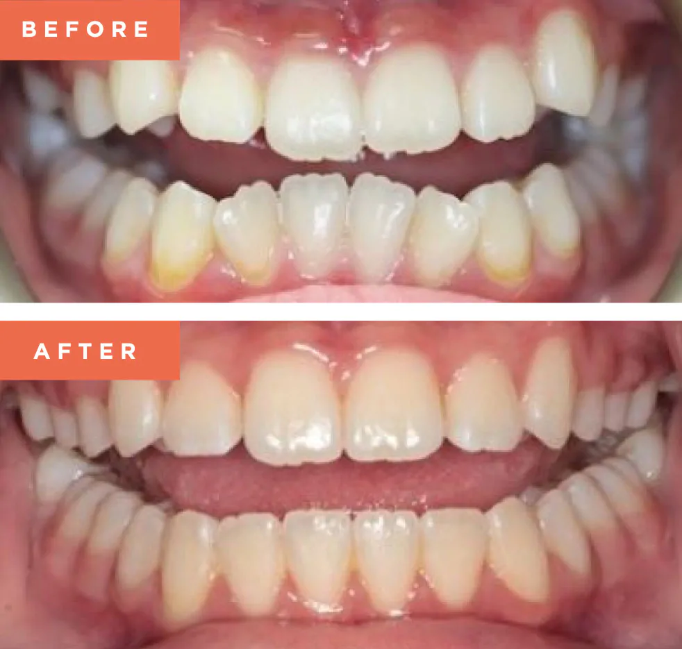 Moreno Valley Smile Gallery